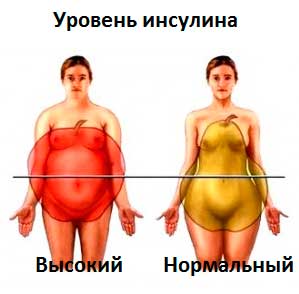 схематическое изображение ожирения при повышенном инсулине