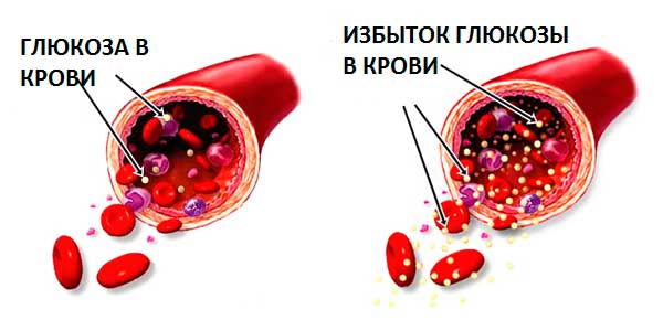 Растворимый цикорий - лечебные свойства и противопоказания